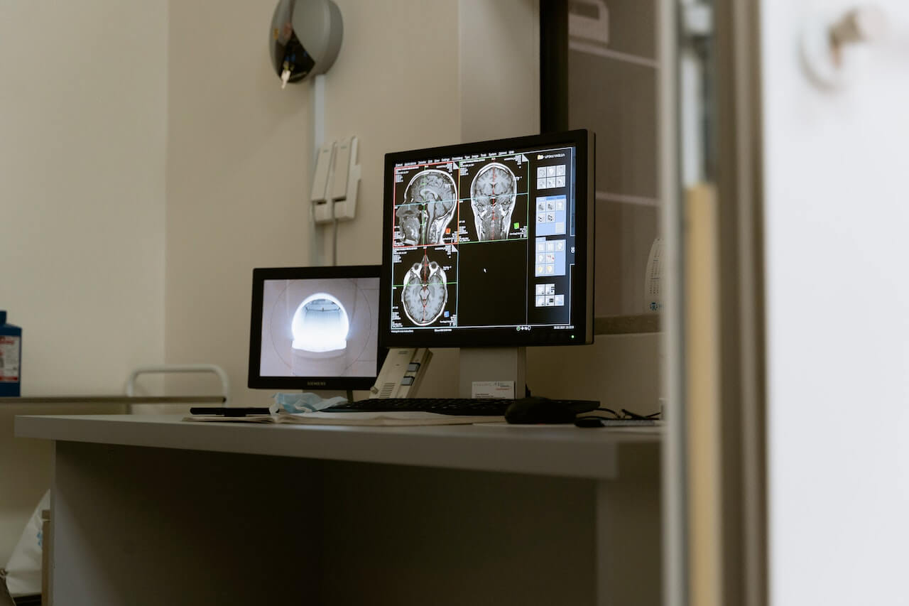 Monitor con delle immagini ottenute in seguito a un'analisi radiologica.