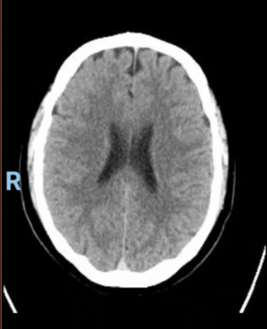 Analisi radiologica del cervello umano.